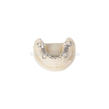 Dental cast bahagyang balangkas